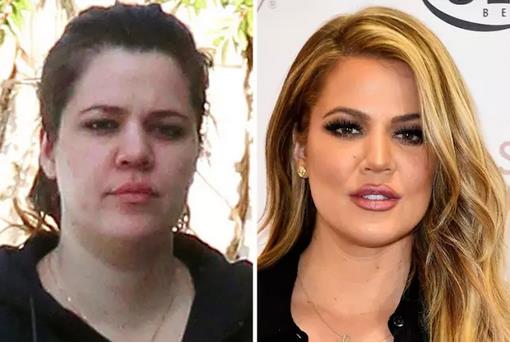 Khloe Kardashian, WD