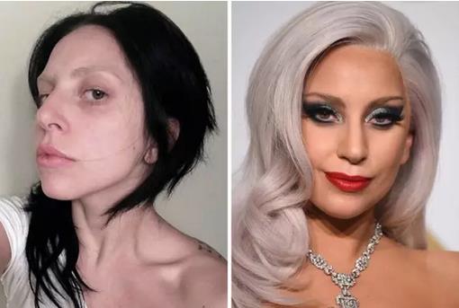 Lady Gaga, q